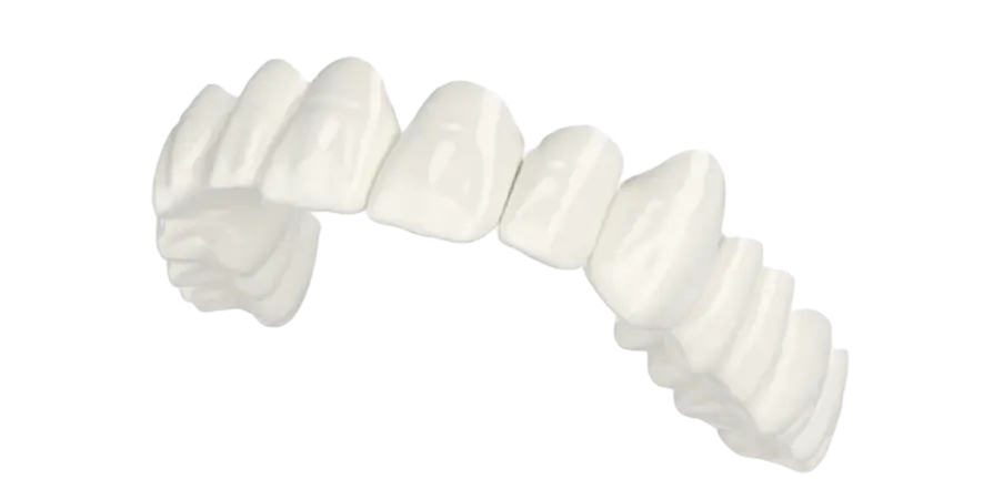 Snap-on veneers