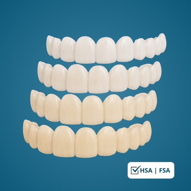 Peak Smile Veneers — 0% APR Financing