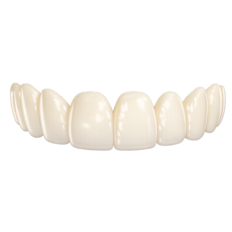 Peak Premium Top Veneers