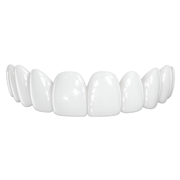 Peak Premium - Top Veneers