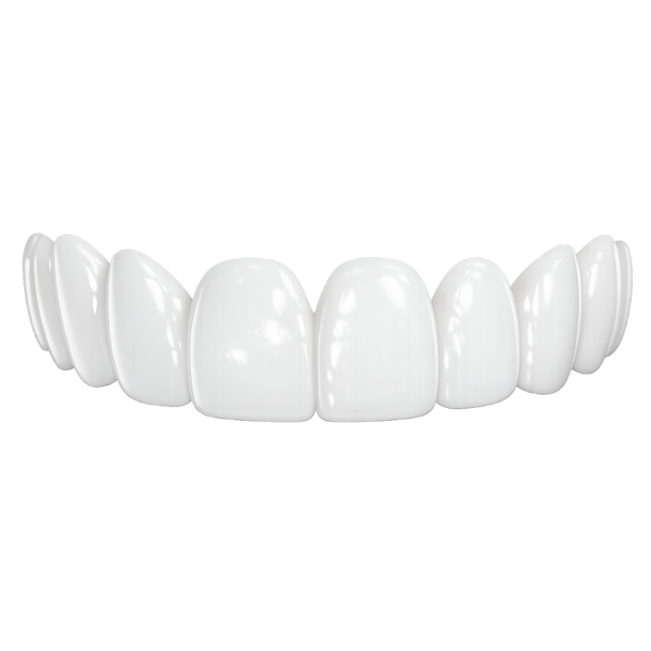 Peak Premium - Top Veneers