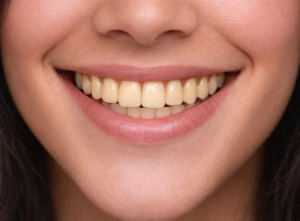 Veneer shade