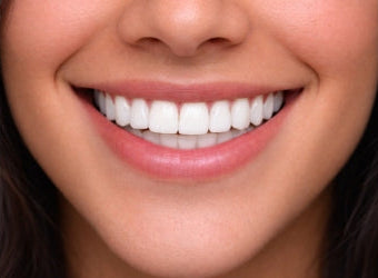 Veneer shade