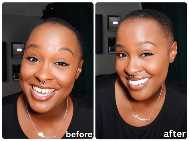 How Peak Smile image