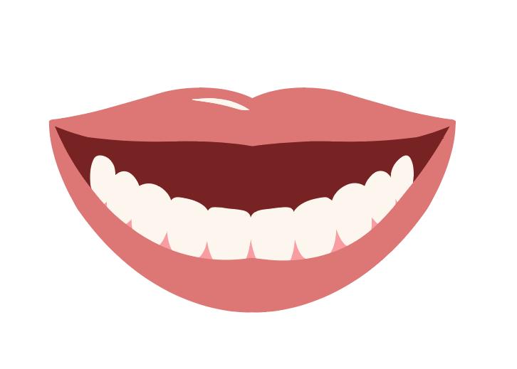 Bottom Arch - Snap on Veneers