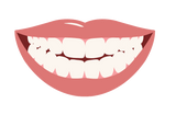 Dual Arch - Snap on Veneers