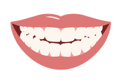 Dual Arch - Snap on Veneers