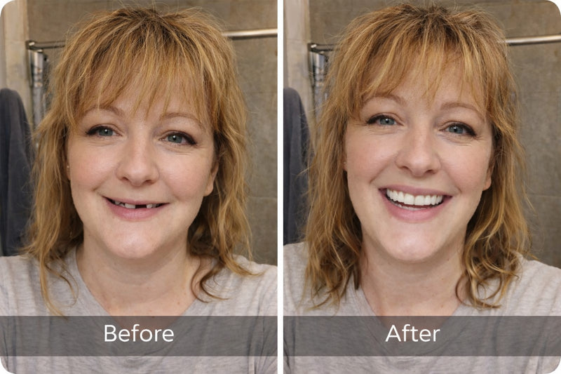 How Peak Smile image