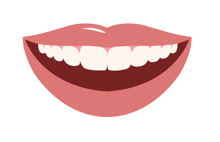 Top Arch - Snap on Veneers