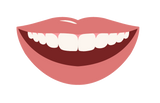 Top Arch - Snap on Veneers