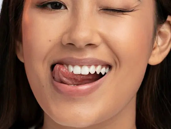 Peak Smile veneers